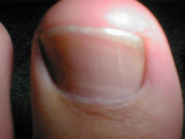 My toenail for you