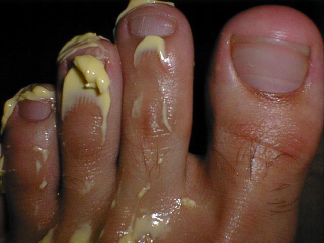 Buttered toes taste so good