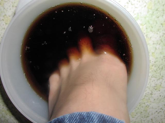 Soaking my feet in soda