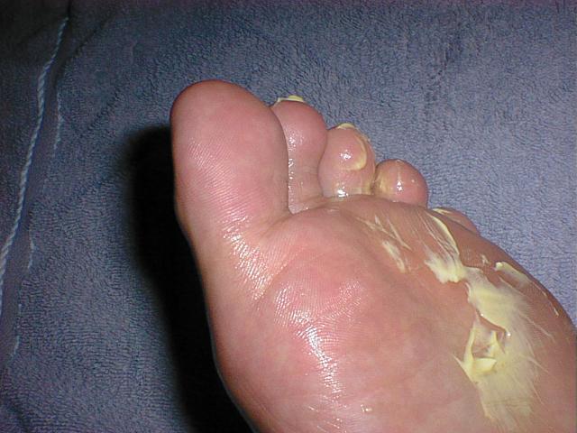 Butter on my soles to eat