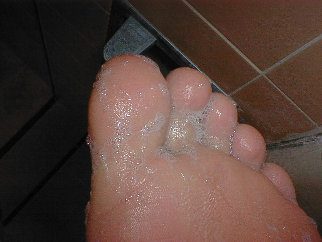 Toes need to be cleaned with soap