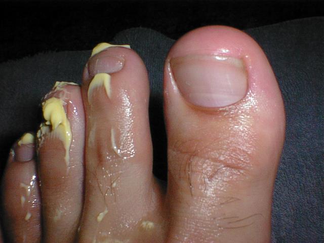 Buttered toes taste good