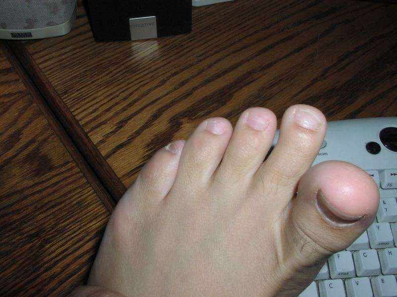 Franks feet and toes