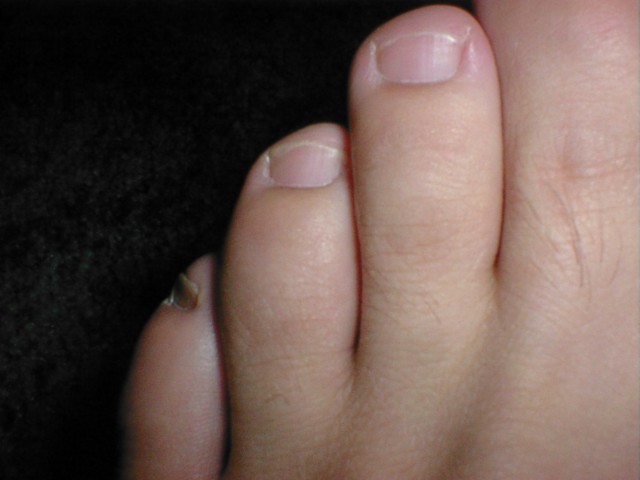 Close up of my tasty toes