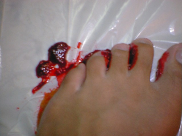 Getting my feet messy with jelly